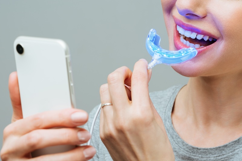 A woman is engaged in home teeth whitening. Complex for teeth whitening with UV lamp.